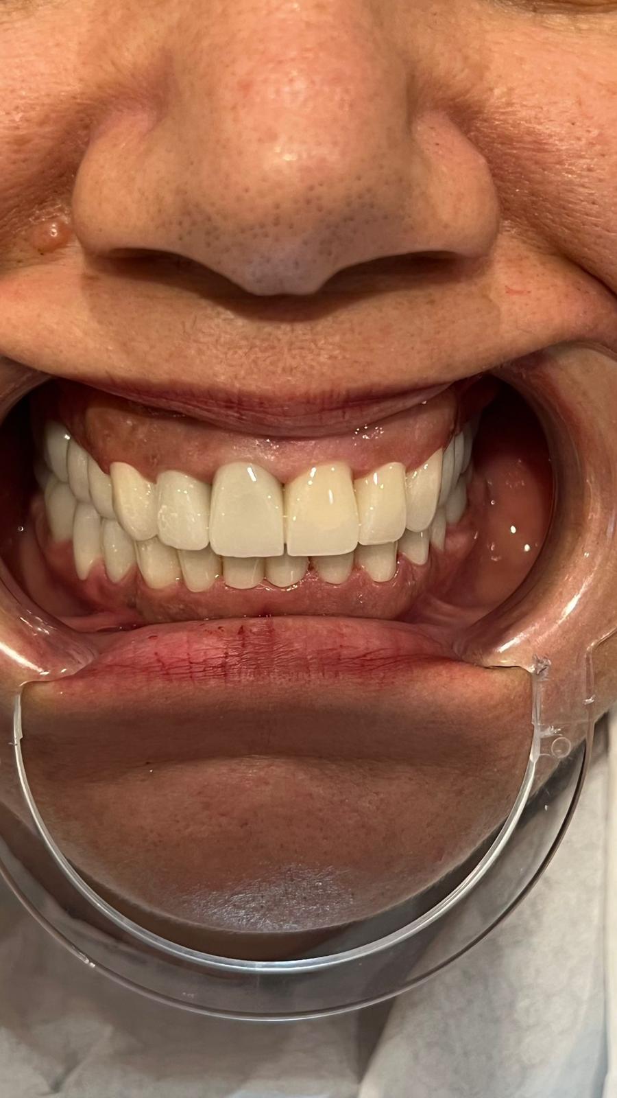 ECE Dental Patient Transformation